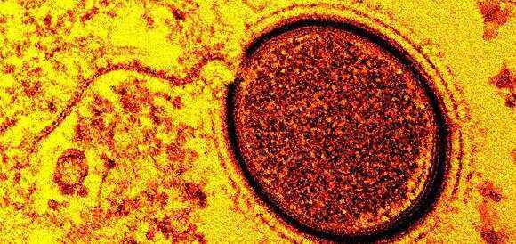 瑞士碾压莱比锡红牛，穆勒打破历史纪录